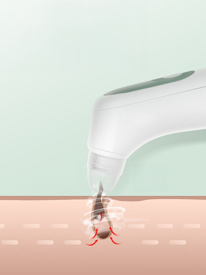 Painless Pore Vacuum Blackhead Extractor